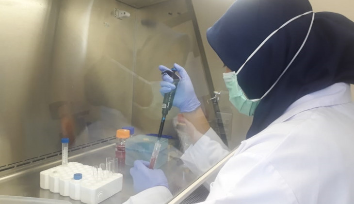 Mahasiswa UGM Kembangkan Senyawa Antikanker Payudara Melalui Reaksi Terinduksi Cahaya   
