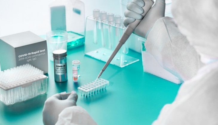 Pemerintah Diharap Lakukan Pengaturan Harga Reagen Rapid Test dan PCR