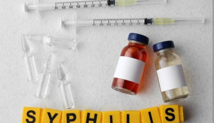 Pakar UGM Tanggapi Soal Kenaikan Kasus HIV-Sifilis di Indonesia