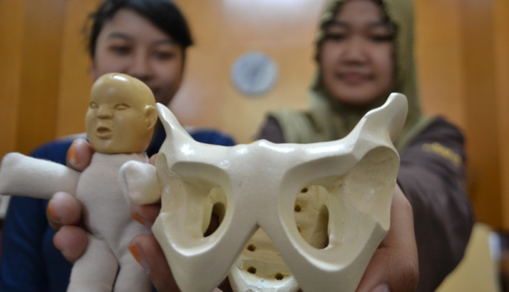 Buat Replika Tulang Panggul Wanita, Karya Mahasiswa UGM ini Banjir Pesanan