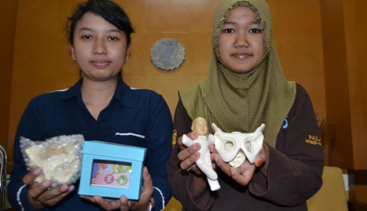 Buat Replika Tulang Panggul Wanita, Karya Mahasiswa UGM ini Banjir Pesanan